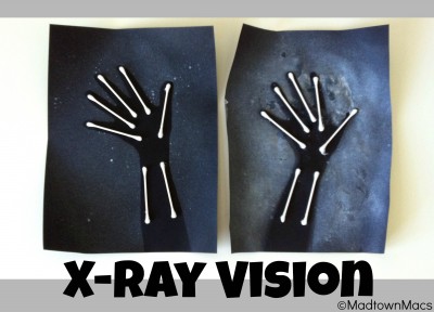 X-Ray Arms