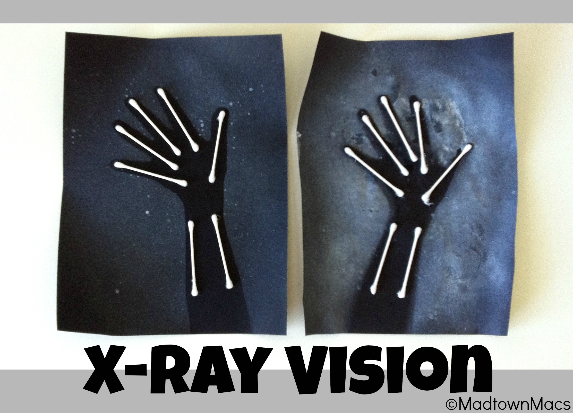 X-Ray Arms | Fun Family Crafts